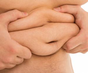 Are You Suffering From Obesity ? Treat Your Obesity Using These Simple Home Remedies